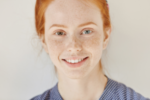 Heterochromia- Its Causes And Types